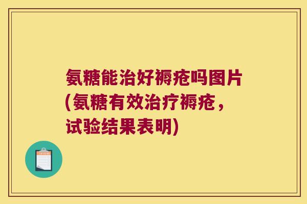 氨糖能治好褥疮吗图片(氨糖有效治疗褥疮,试验结果表明)