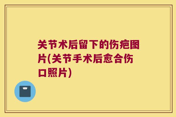 关节术后留下的伤疤图片(关节手术后愈合伤口照片)