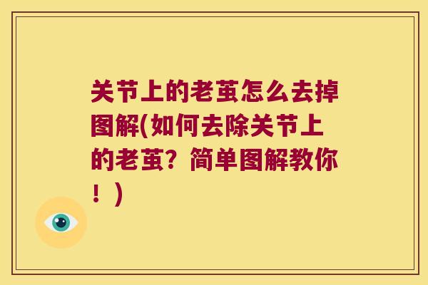 关节上的老茧怎么去掉图解(如何去除关节上的老茧?简单图解教你!)