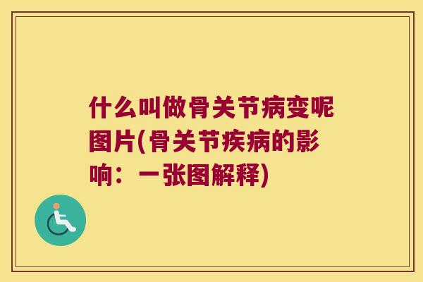 什么叫做骨关节病变呢图片(骨关节疾病的影响:一张图解释)