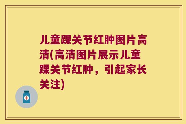 儿童踝关节红肿图片高清(高清图片展示儿童踝关节红肿,引起家长关注)
