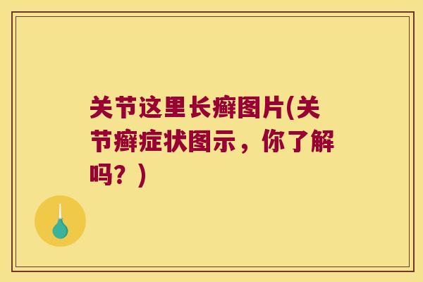 关节这里长癣图片(关节癣症状图示,你了解吗?)