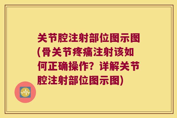 关节腔注射部位图示图(骨关节疼痛注射该如何正确操作？详解关节腔注射部位图示图)
