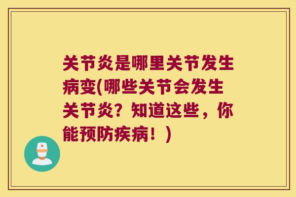 关节炎是哪里关节发生病变(哪些关节会发生关节炎?知道这些,你能预防疾病!)