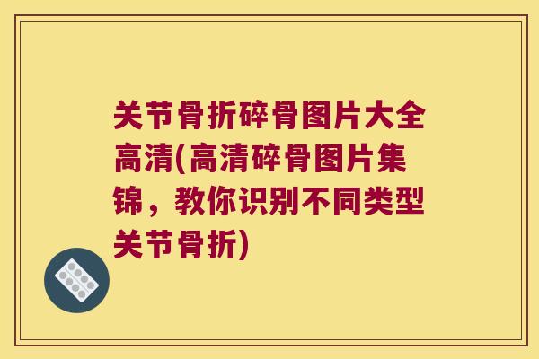 关节骨折碎骨图片大全高清(高清碎骨图片集锦，教你识别不同类型关节骨折)
