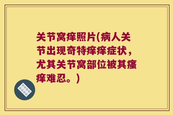 关节窝痒照片(病人关节出现奇特痒痒症状,尤其关节窝部位被其瘙痒难忍。)