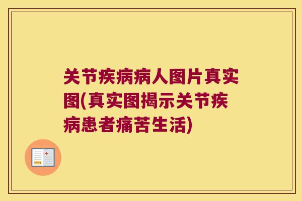 关节疾病病人图片真实图(真实图揭示关节疾病患者痛苦生活)