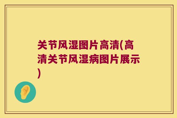 关节风湿图片高清(高清关节风湿病图片展示)