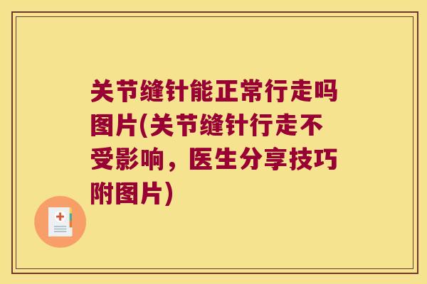 关节缝针能正常行走吗图片(关节缝针行走不受影响,医生分享技巧附图片)