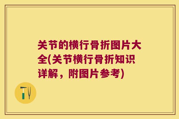关节的横行骨折图片大全(关节横行骨折知识详解,附图片参考)