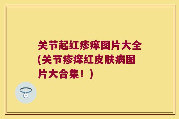 关节起红疹痒图片大全(关节疹痒红皮肤病图片大合集!)