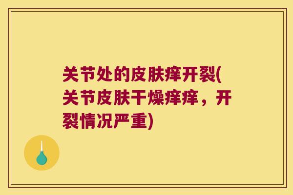 关节处的皮肤痒开裂(关节皮肤干燥痒痒,开裂情况严重)