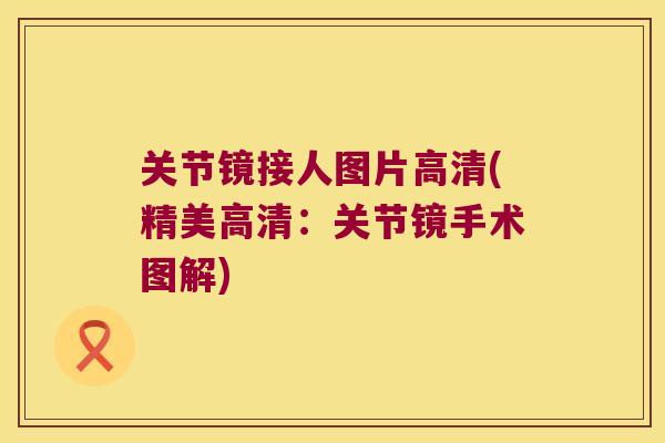 关节镜接人图片高清(精美高清:关节镜手术图解)