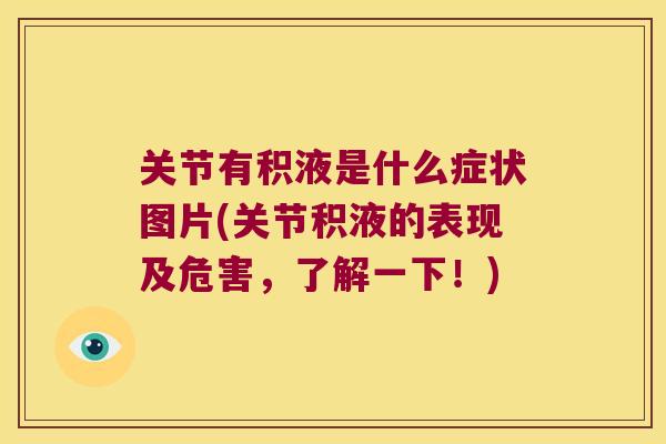 关节有积液是什么症状图片(关节积液的表现及危害,了解一下!)