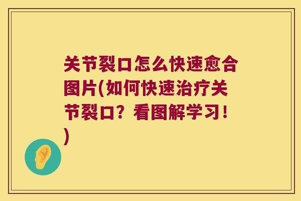 关节裂口怎么快速愈合图片(如何快速治疗关节裂口?看图解学习!)