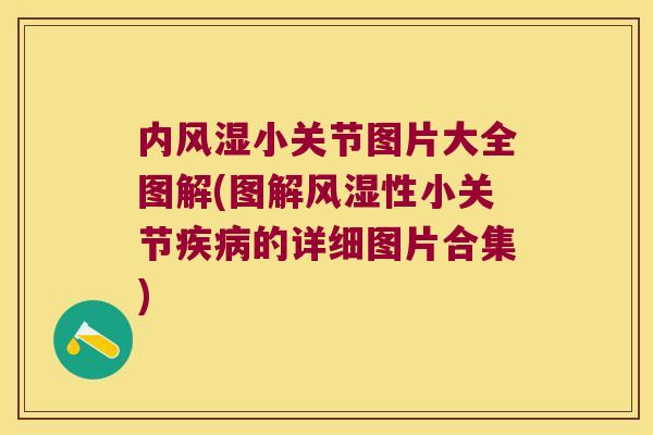 内风湿小关节图片大全图解(图解风湿性小关节疾病的详细图片合集)