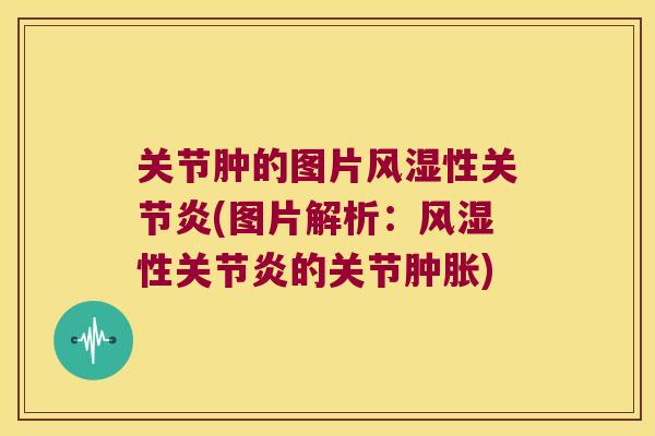 关节肿的图片风湿性关节炎(图片解析:风湿性关节炎的关节肿胀)