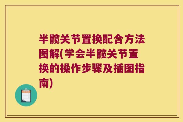 半髋关节置换配合方法图解(学会半髋关节置换的操作步骤及插图指南)