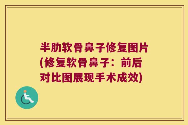 半肋软骨鼻子修复图片(修复软骨鼻子:前后对比图展现手术成效)