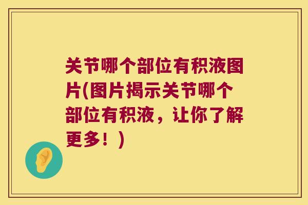 关节哪个部位有积液图片(图片揭示关节哪个部位有积液，让你了解更多！)