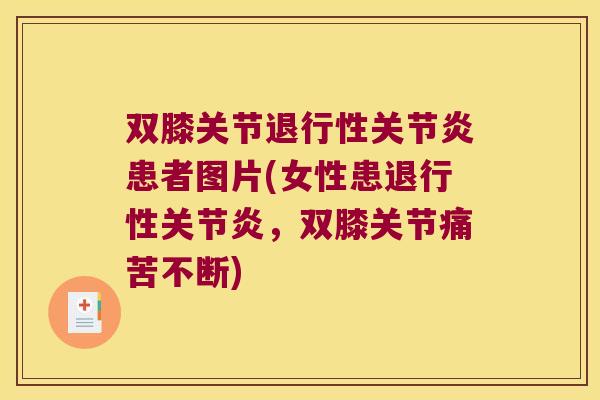 双膝关节退行性关节炎患者图片(女性患退行性关节炎,双膝关节痛苦不断)