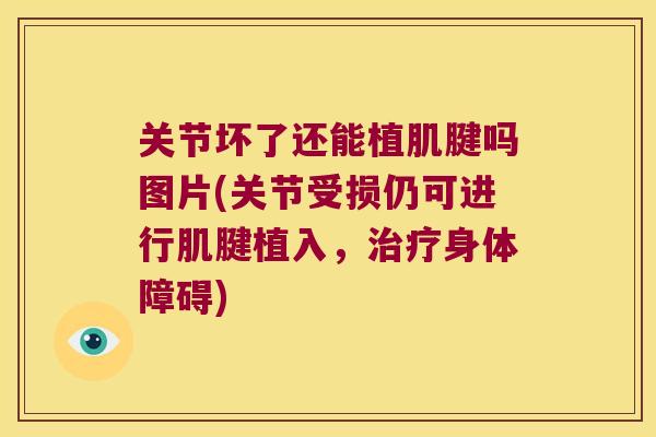 关节坏了还能植肌腱吗图片(关节受损仍可进行肌腱植入,治疗身体障碍)