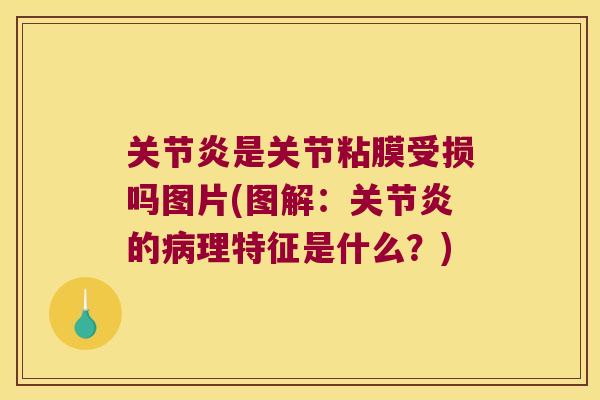 关节炎是关节粘膜受损吗图片(图解:关节炎的病理特征是什么?)