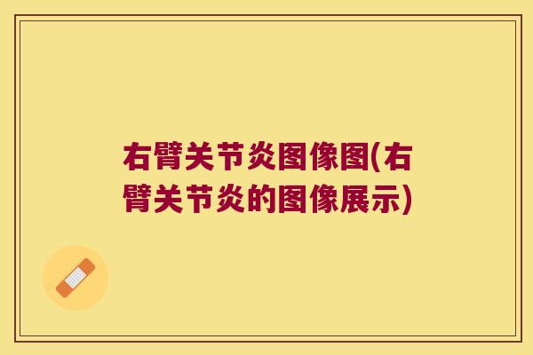 右臂图像图(右臂的图像展示)