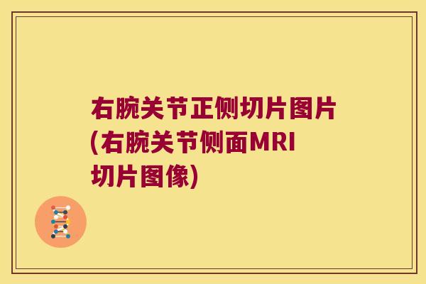 右腕关节正侧切片图片(右腕关节侧面MRI切片图像)