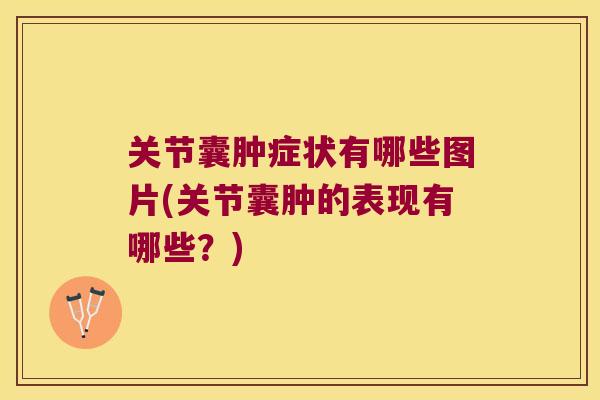 关节囊肿症状有哪些图片(关节囊肿的表现有哪些?)