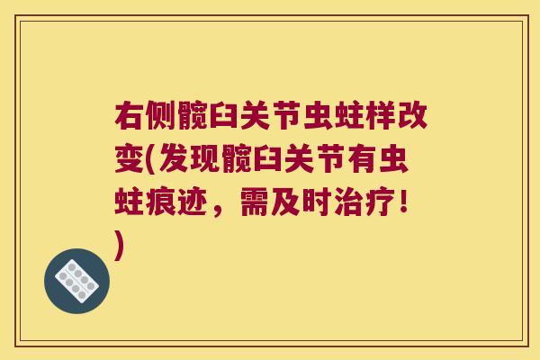 右侧髋臼关节虫蛀样改变(发现髋臼关节有虫蛀痕迹,需及时治疗!)