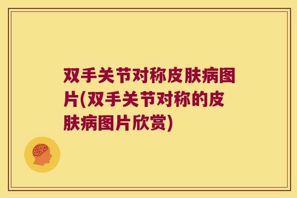双手关节对称皮肤病图片(双手关节对称的皮肤病图片欣赏)