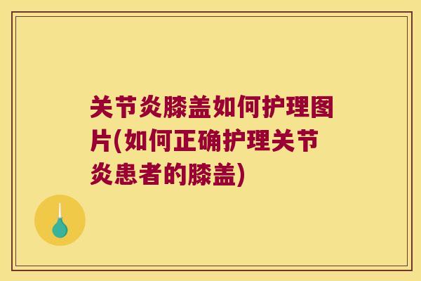关节炎膝盖如何护理图片(如何正确护理关节炎患者的膝盖)