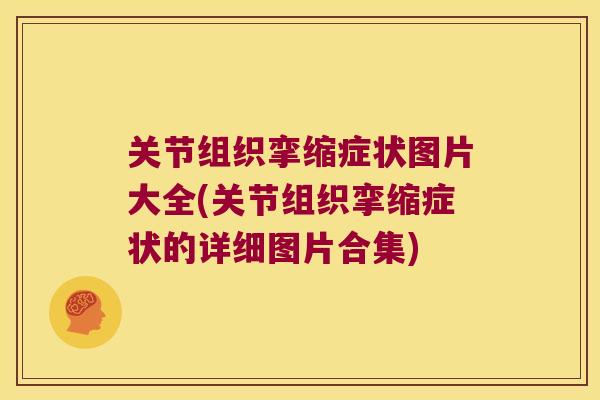关节组织挛缩症状图片大全(关节组织挛缩症状的详细图片合集) 关节组织挛缩症状图片大全(关节组织挛缩症状的详细图片合集)