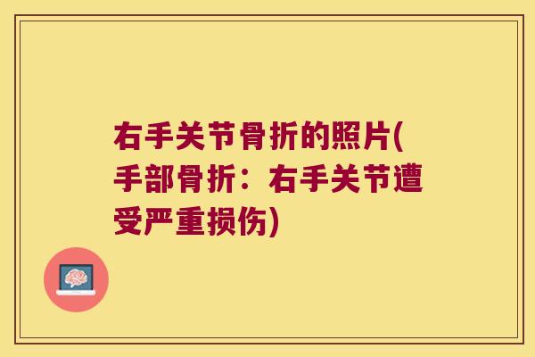 右手关节骨折的照片(手部骨折:右手关节遭受严重损伤)