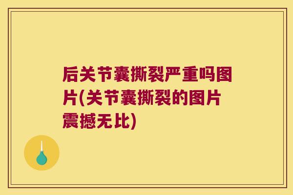 后关节囊撕裂严重吗图片(关节囊撕裂的图片震撼无比)