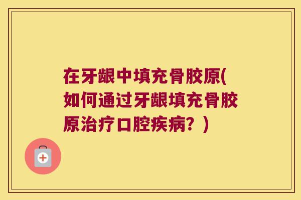 在牙龈中填充骨胶原(如何通过牙龈填充骨胶原治疗口腔疾病?)