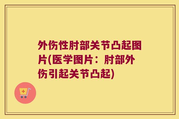 外伤性肘部关节凸起图片(医学图片:肘部外伤引起关节凸起)