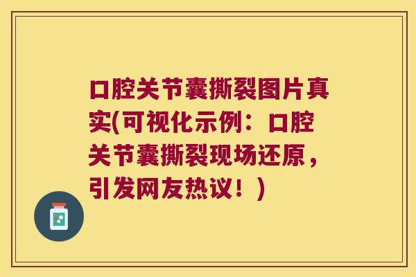 口腔关节囊撕裂图片真实(可视化示例:口腔关节囊撕裂现场还原,引发网友热议!)