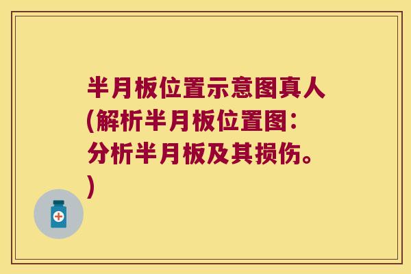 半月板位置示意图真人(解析半月板位置图:分析半月板及其损伤。)