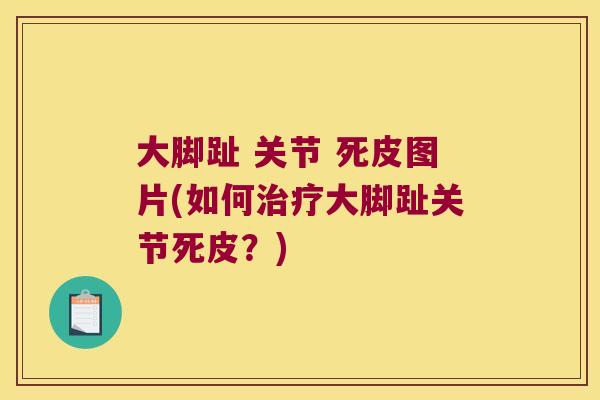 大脚趾 关节 死皮图片(如何治疗大脚趾关节死皮?)