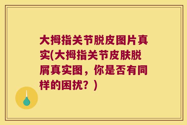 大拇指关节脱皮图片真实(大拇指关节皮肤脱屑真实图,你是否有同样的困扰?)