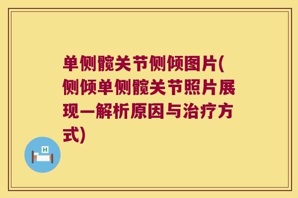 单侧髋关节侧倾图片(侧倾单侧髋关节照片展现—解析原因与治疗方式)