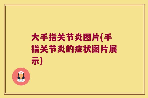 大手指关节炎图片(手指关节炎的症状图片展示)