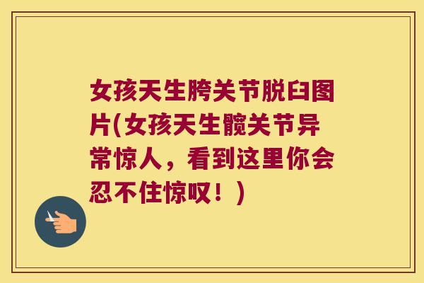 女孩天生胯关节脱臼图片(女孩天生髋关节异常惊人,看到这里你会忍不住惊叹!)