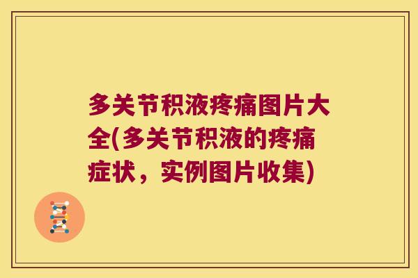 多关节积液疼痛图片大全(多关节积液的疼痛症状,实例图片收集)