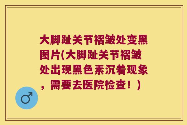 大脚趾关节褶皱处变黑图片(大脚趾关节褶皱处出现黑色素沉着现象,需要去医院检查!)