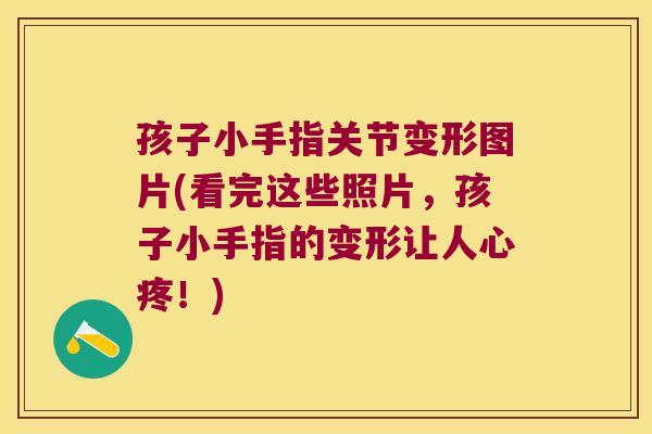 孩子小手指关节变形图片(看完这些照片,孩子小手指的变形让人心疼!)
