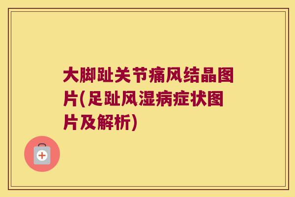 大脚趾关节痛风结晶图片(足趾风湿病症状图片及解析)