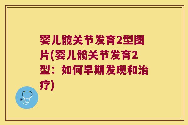 婴儿髋关节发育2型图片(婴儿髋关节发育2型:如何早期发现和治疗)